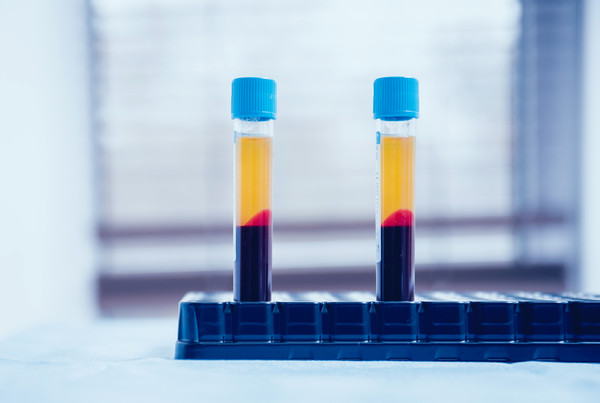 citrate synthase